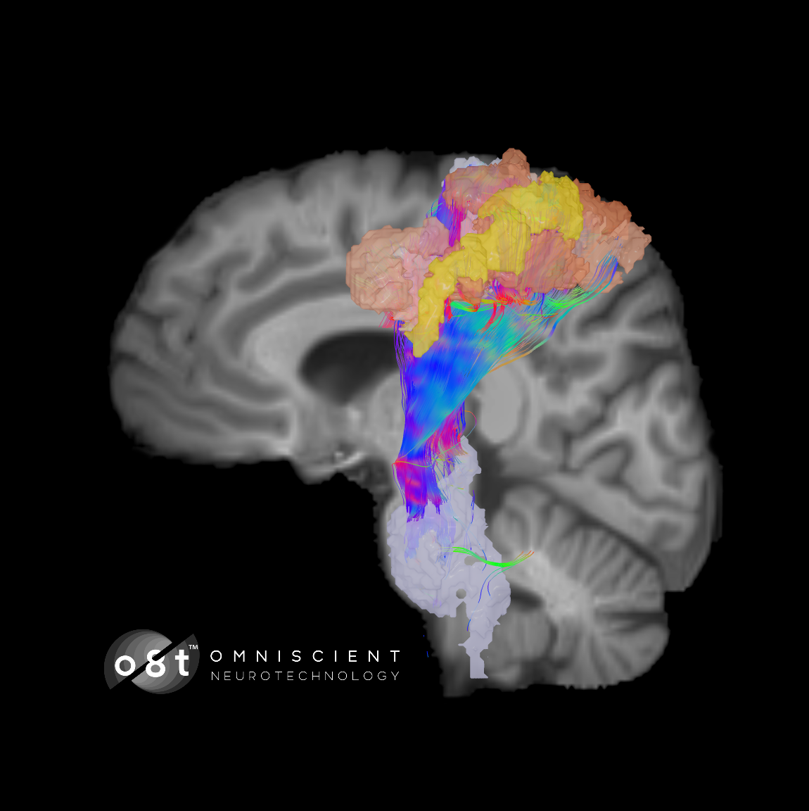 Quicktome FC by Omniscient Neurotechnology