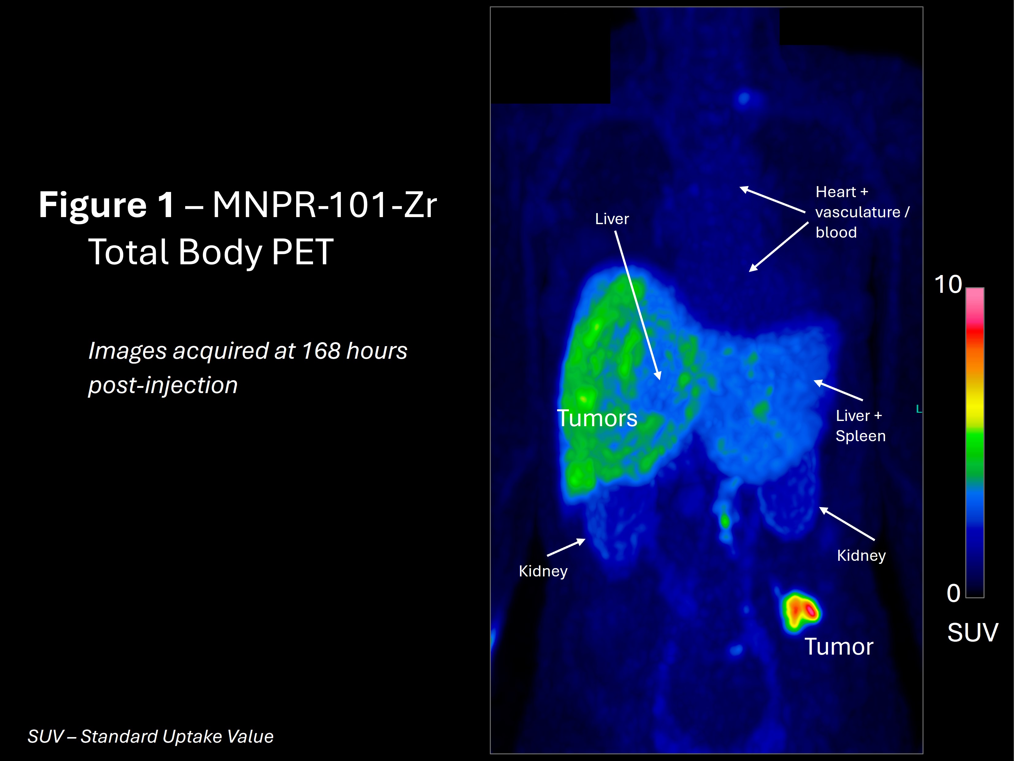 MNPR-101-Zr Total Body PET