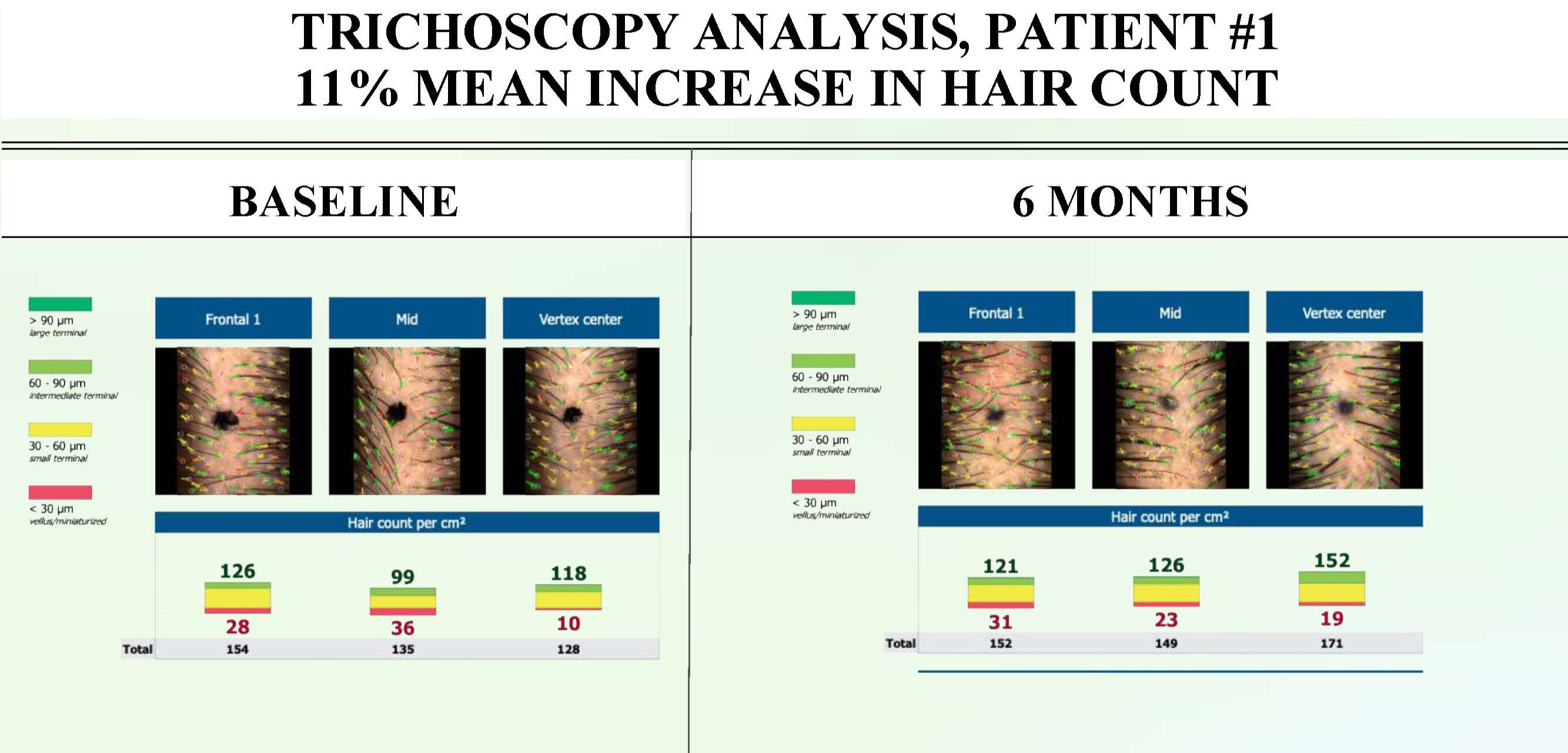 Hair growth analysis