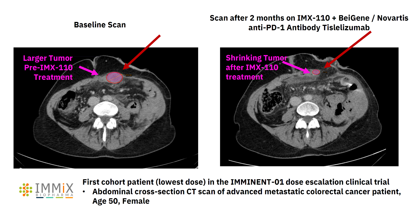 Immix Biopharma Announces Early Positive IMX-110 Interim Clinical Trial ...