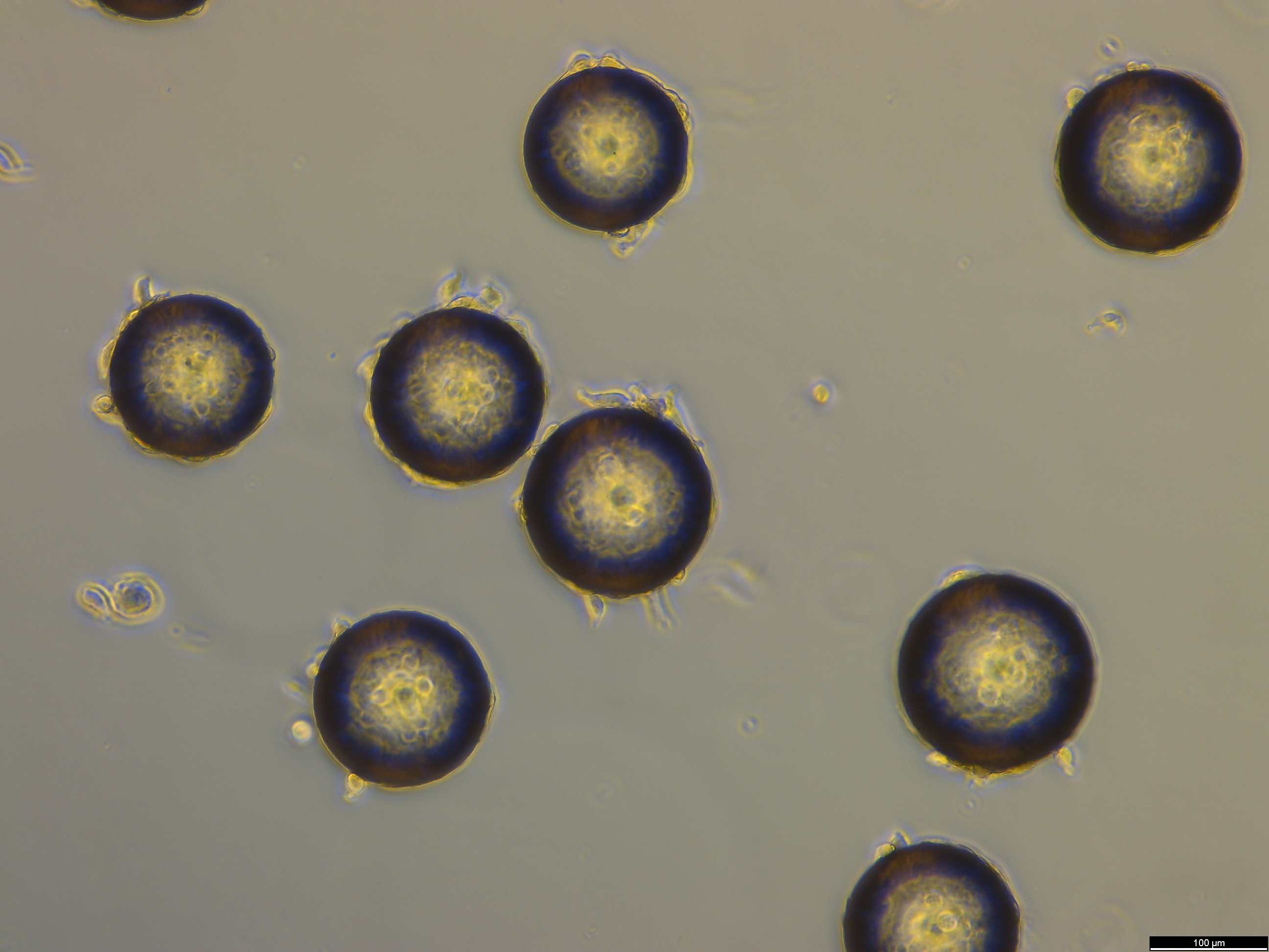 Bone-derived human mesenchymal stem cells (bt-hMSCs) attached to microcarriers in the 80-liter bioreactor.