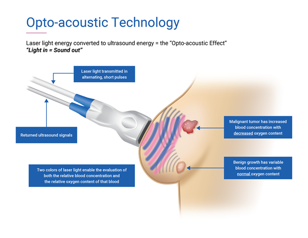 Seno Medical’s Imagio® Breast Imaging System uses non-invasive opto-acoustic ultrasound (OA/US) technology to provide information on suspicious breast lesions in real time, helping providers characterize and differentiate masses that may - or may not - require more invasive diagnostic evaluation. 