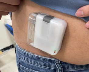 CCBIO’s Felice Dose on-body wearable device prototype worn on a person