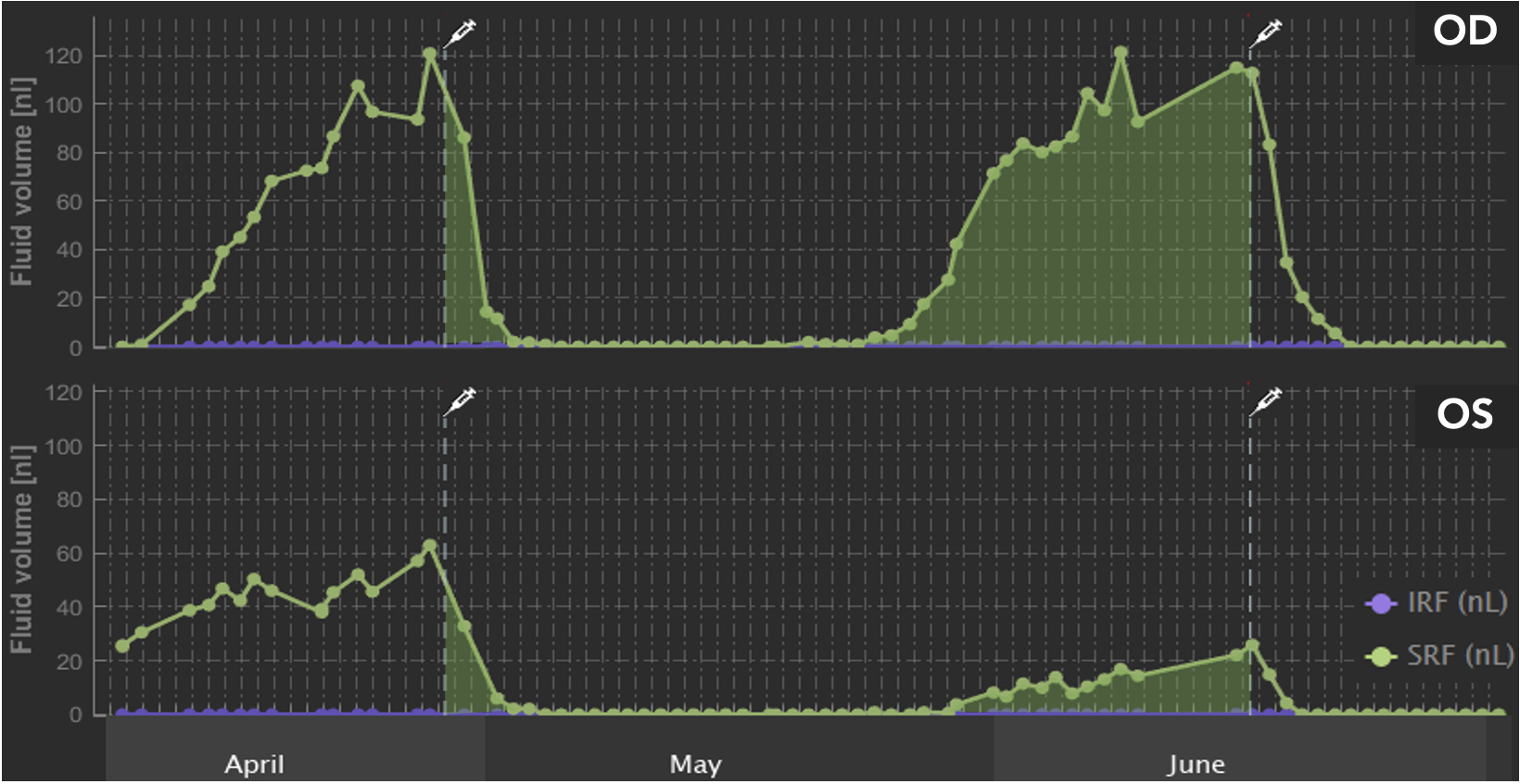 Home OCT NOA Fluid Volume Trajectory