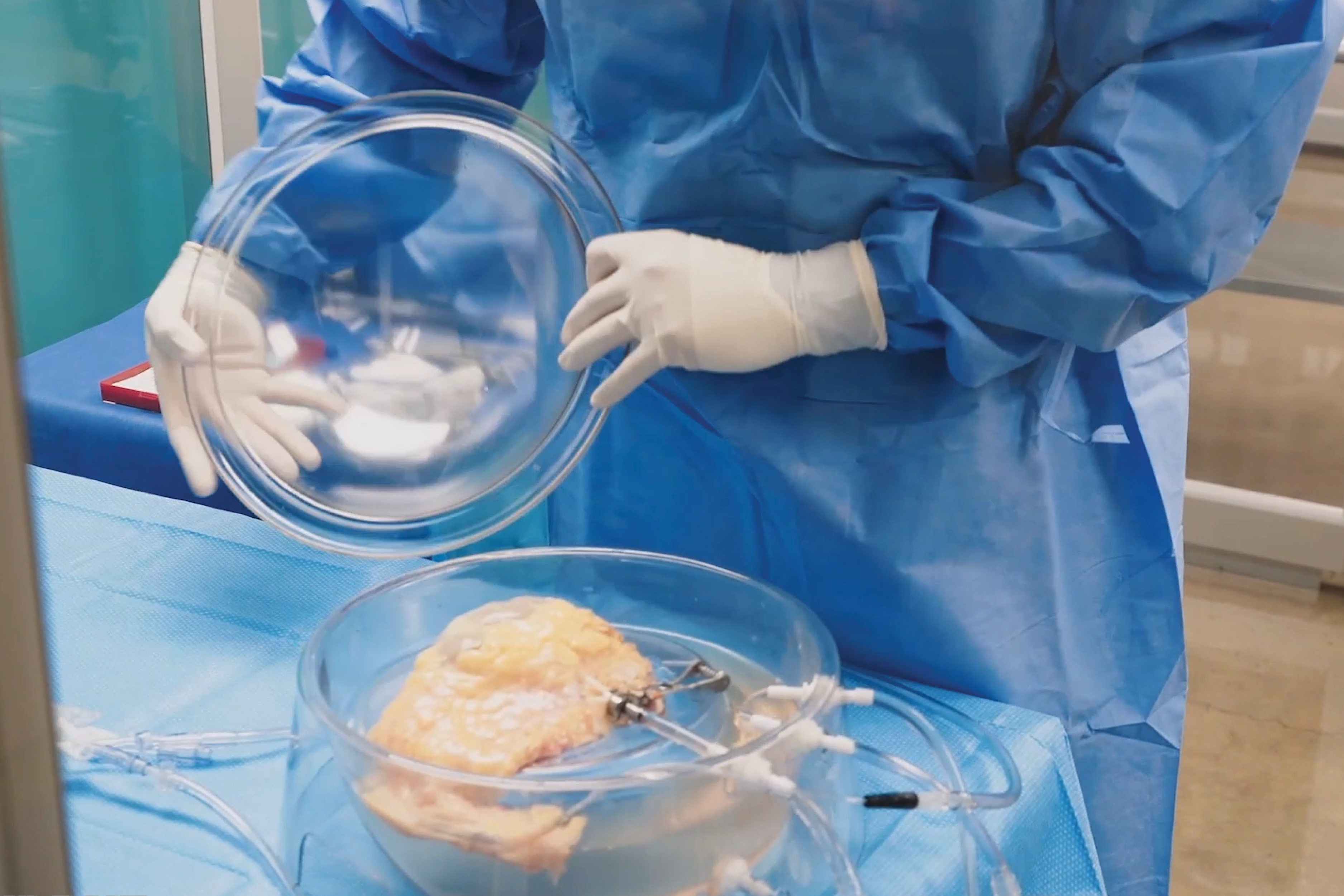 34 Lives has already saved 10 lives with “unusable” kidneys — and they’re just getting started 