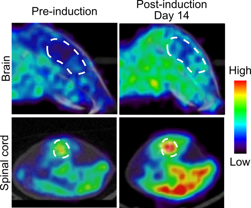 PET scans showing mouse brain and spinal cord dCK activity before (left) and after (right) disease induction. The enzyme dCK becomes upregulated during MS disease.