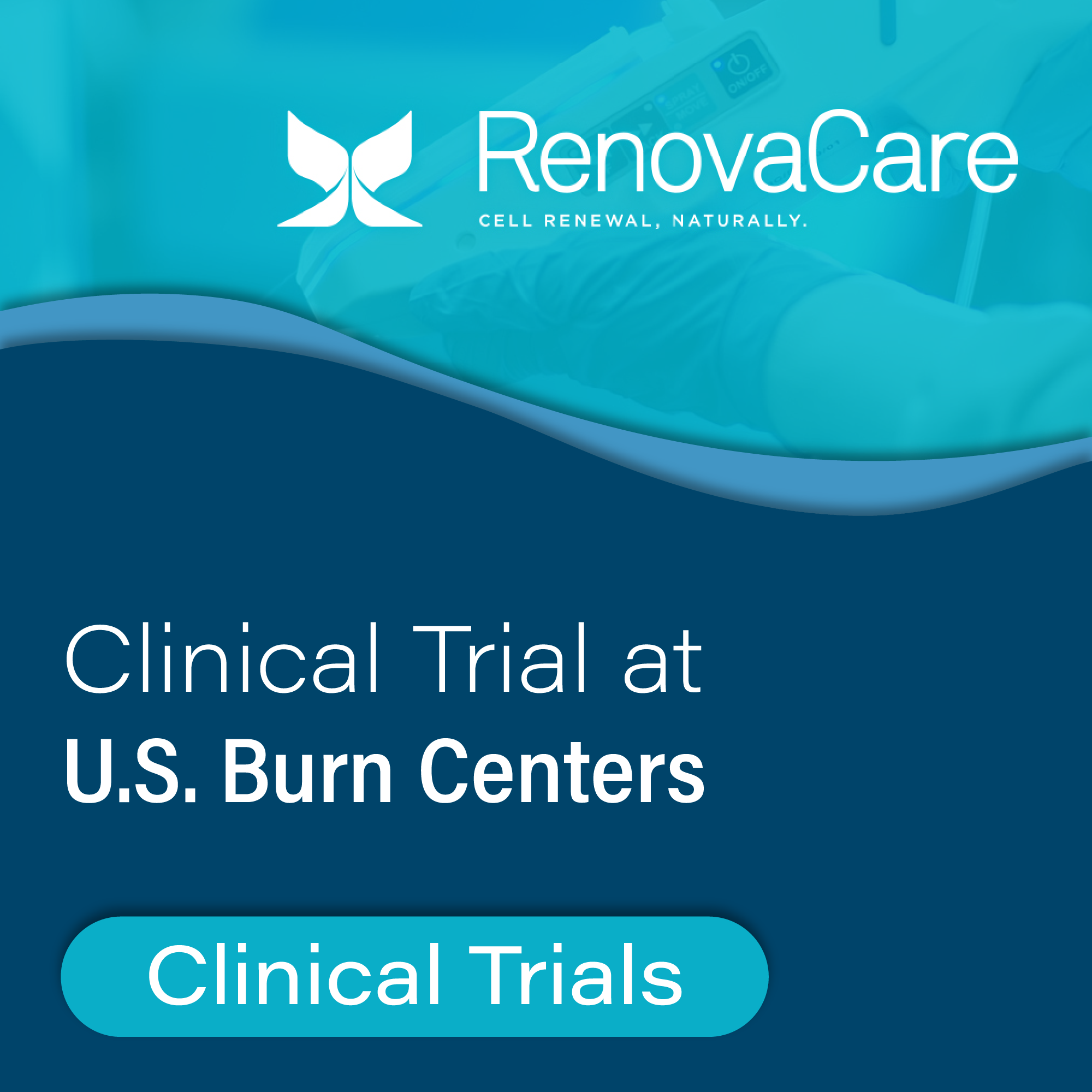 RenovaCare Announces Start of Clinical Trials at U.S. Burn Centers