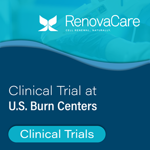 RenovaCare Clinical Trial to Start at U.S. Burn Centers
