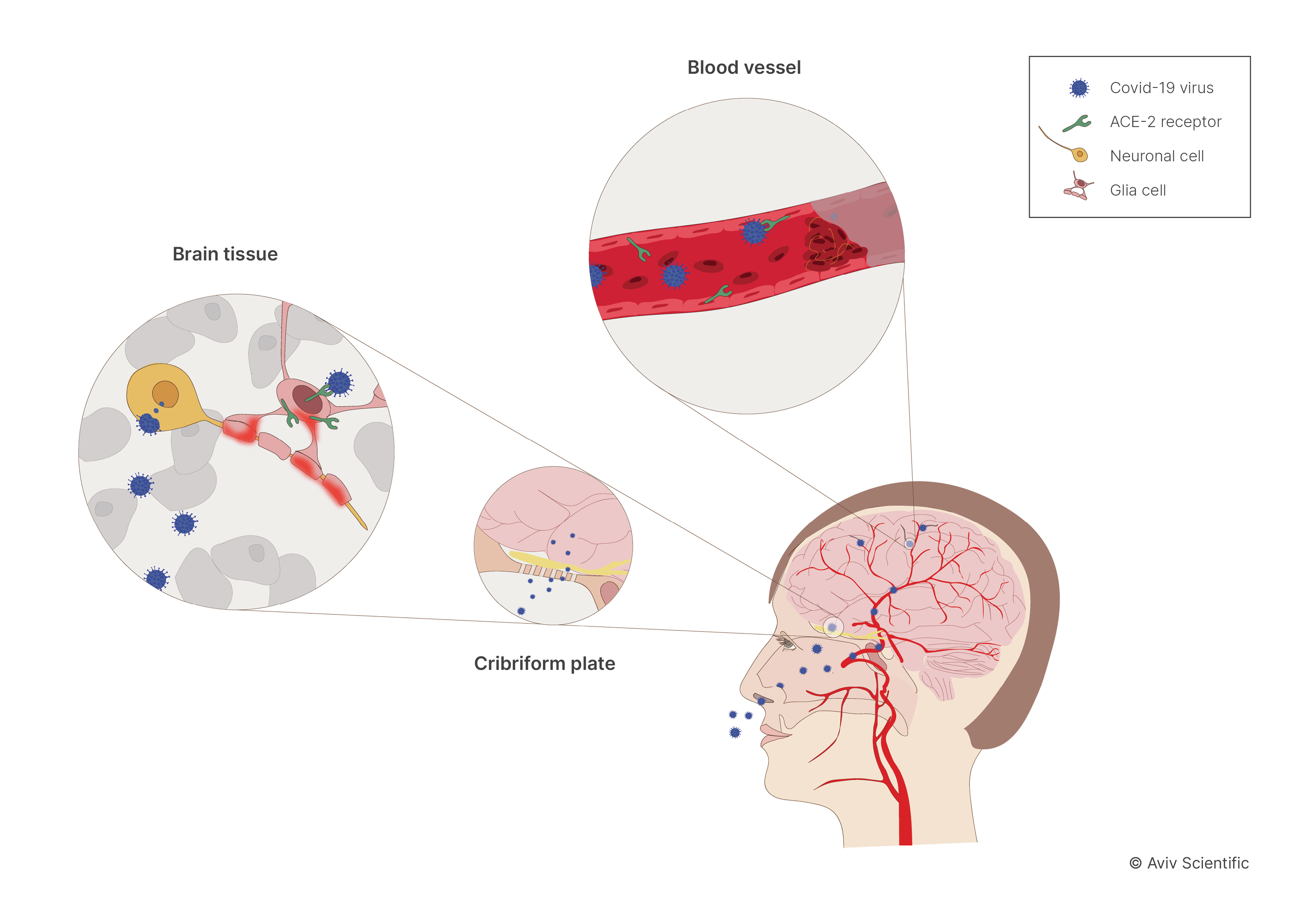 long-covid-impact-on-brain-aviv