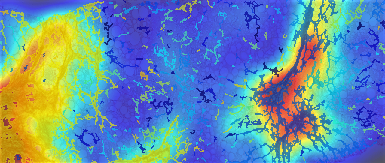 FibroNest Liver NASH Biopsy Quantitative Image Analysis