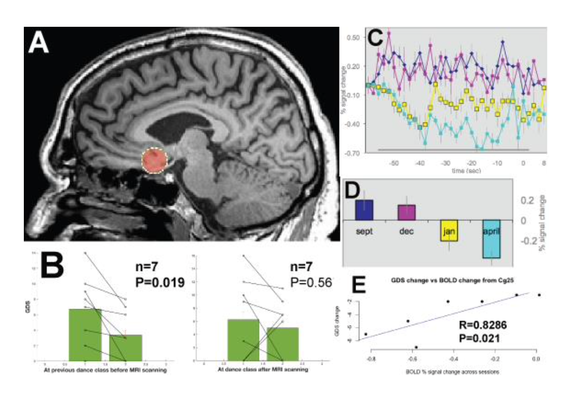 MRI findings