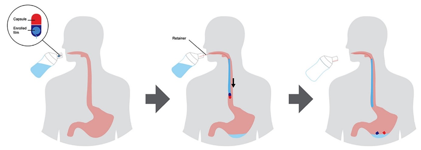 Diagram of EsoCap application, Krause et al. 2020. © EsoCap AG