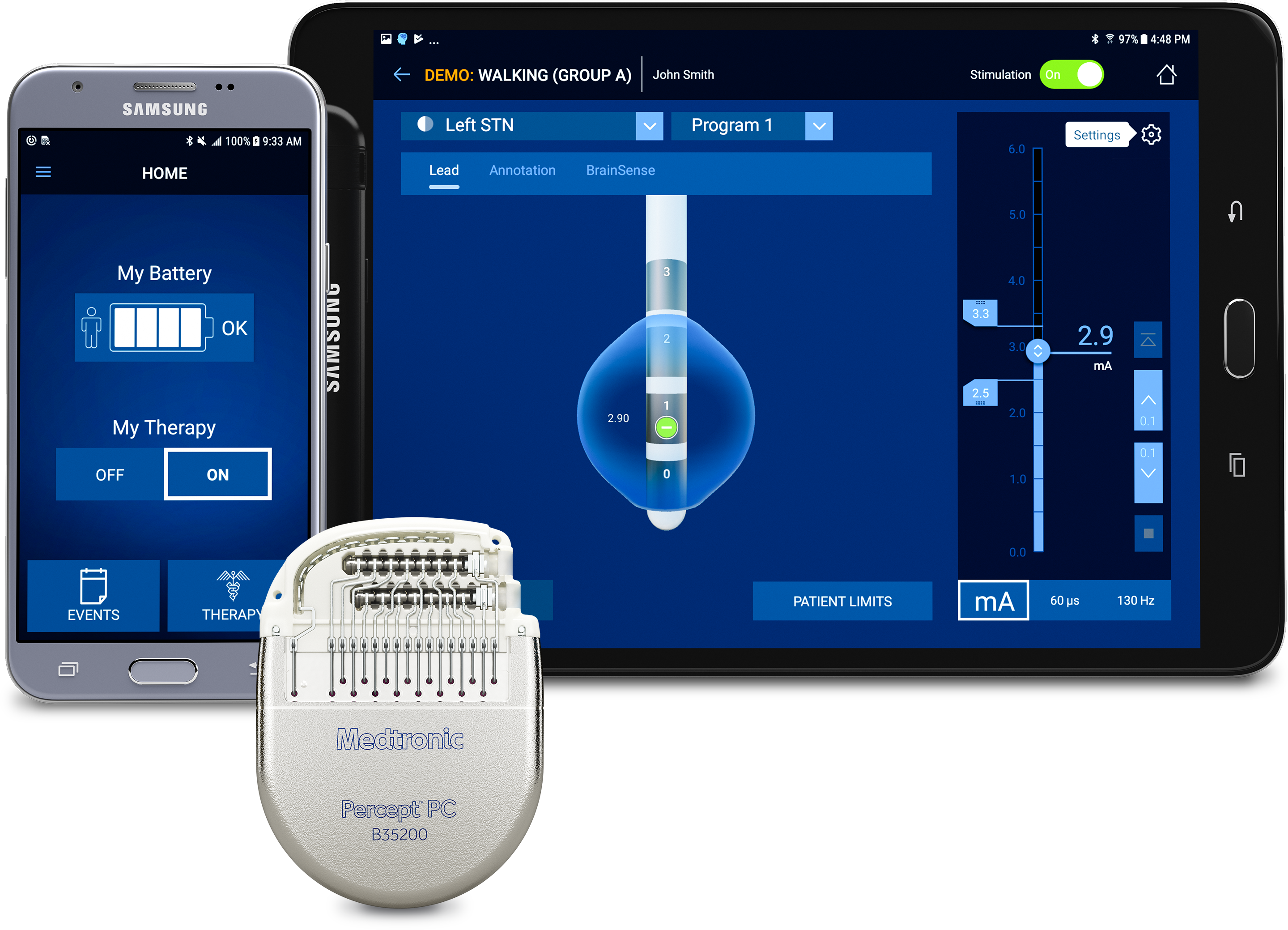 Medtronic Receives CE Mark Approval for the Percept™ PC Neurostimulator DBS  System with BrainSense™ Technology NYSE:MDT