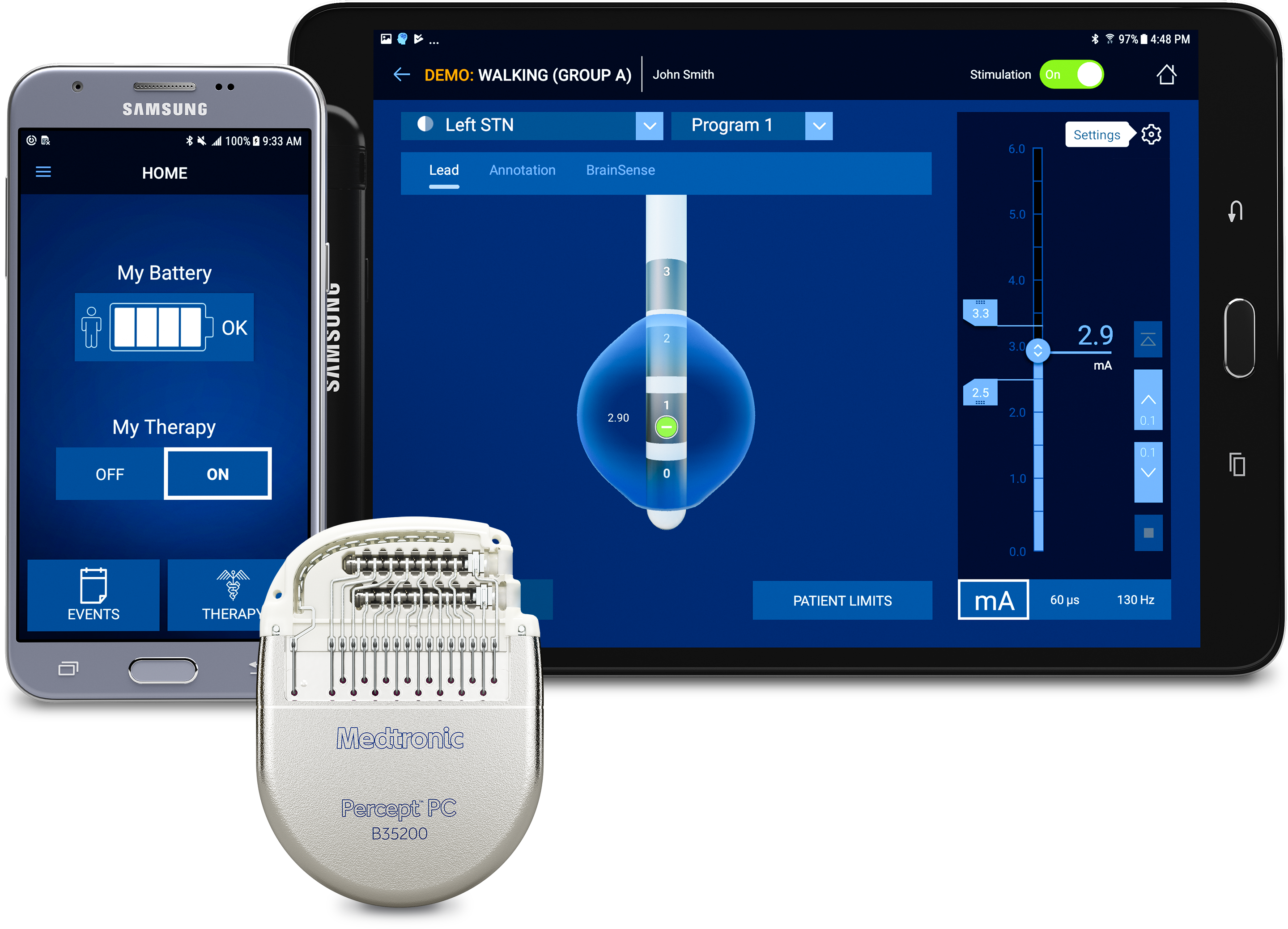 Percept™ PC Neurostimulator Showing Stimulation  