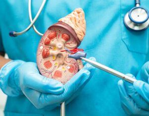Shareholder sues Ardelyx, Inc. for misleading investors