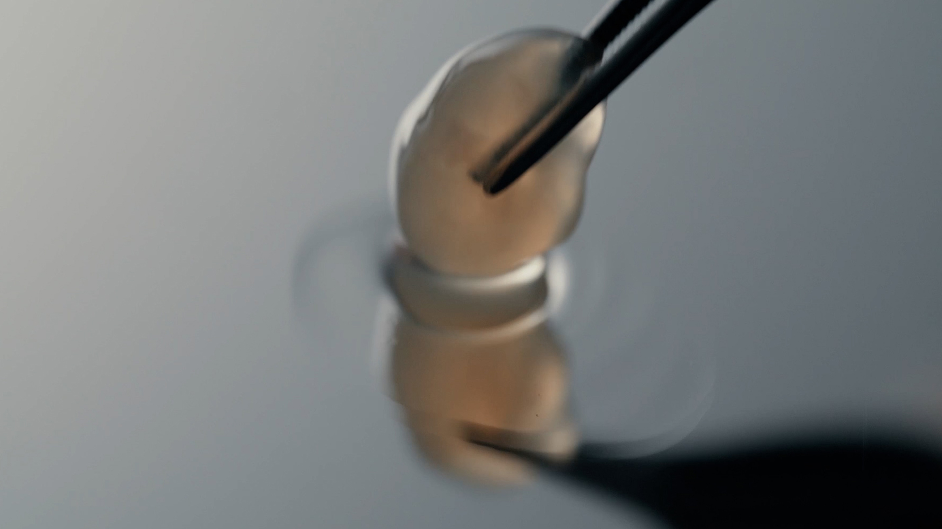 Ten Minute Tissue™ with CXU™; a thermo-sensitive extracellular matrix (ECM), designed to gel in situ at body temperature in approximately ten minutes, for stabilized integration.