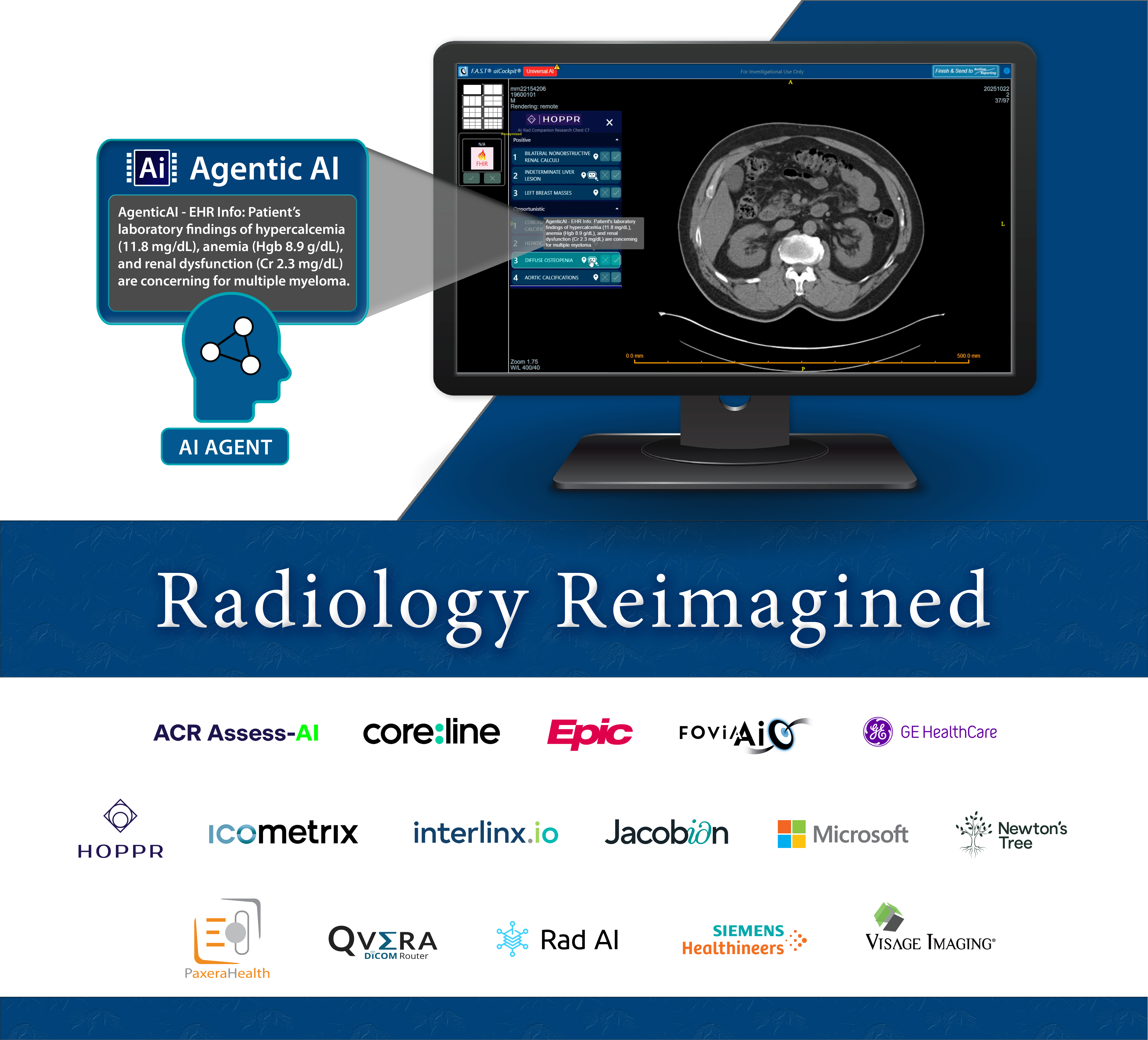 Fovia AI to Showcase Universal AI Viewer and Seamless Reporting Integrations at Radiology Reimagined Exhibit, RSNA 2025