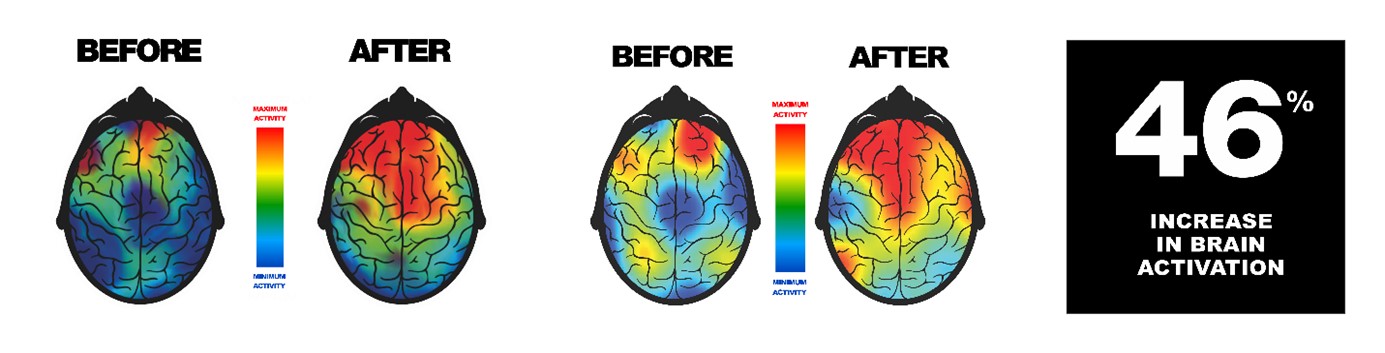 EEG Brain Scan