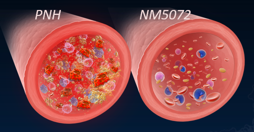 By blocking Properdin function, NM5072 is expected to block the PNH RBC lysis, which is implicated in the pathophysiology of anemia in PNH.