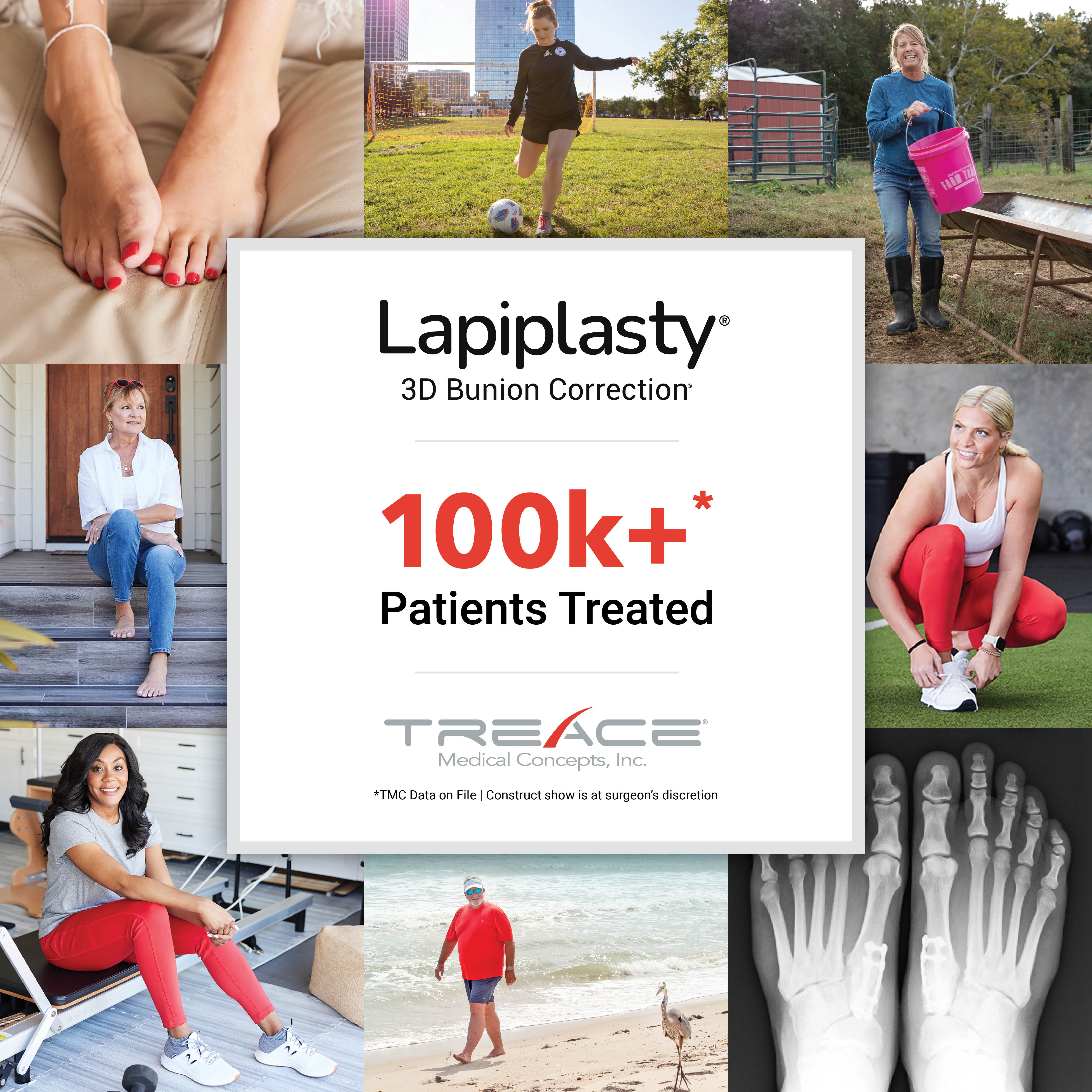 Lapiplasty Negative Reviews - sfq0xa2