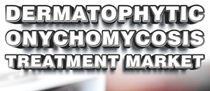 Dermatophytic Onychomycosis Treatment Market globenewswire