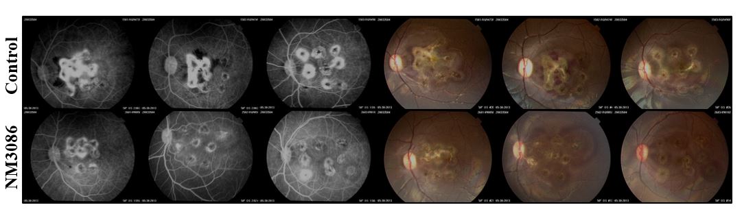 Fluoresceine angiogram data from three animals treated with NM3086 (bottom) and three that received placebo control. The picture shows reduced hemorrhage and neovascularization (Left) and Fibrosis (Right) in the drug-treated animals.