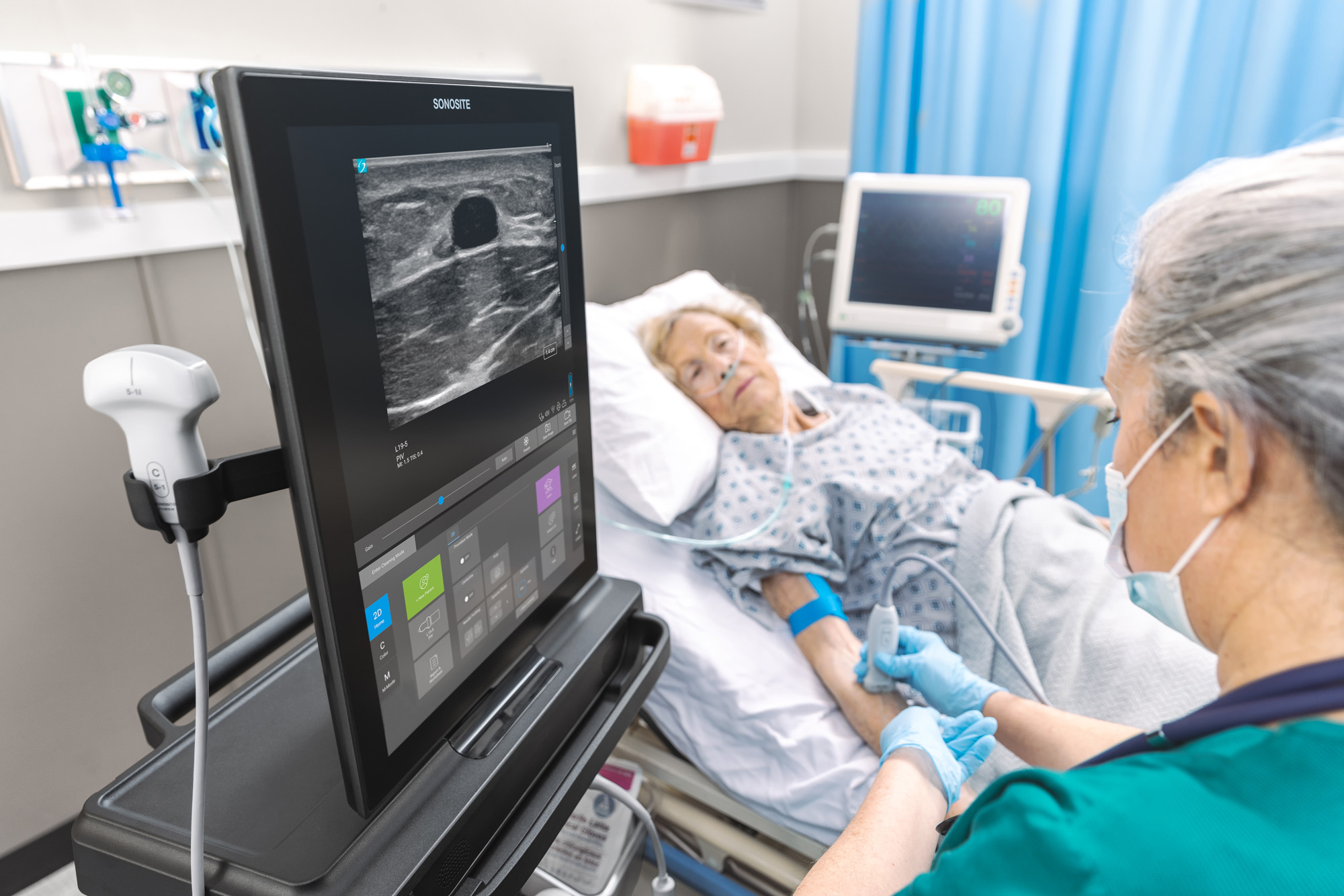 Sonosite ST POCUS System