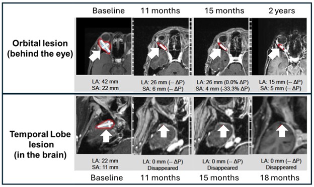 Example 1 Images (Patient 11-018):