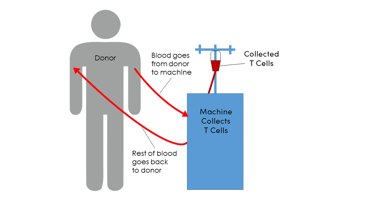 Illustration of the CAR-T cell therapy process