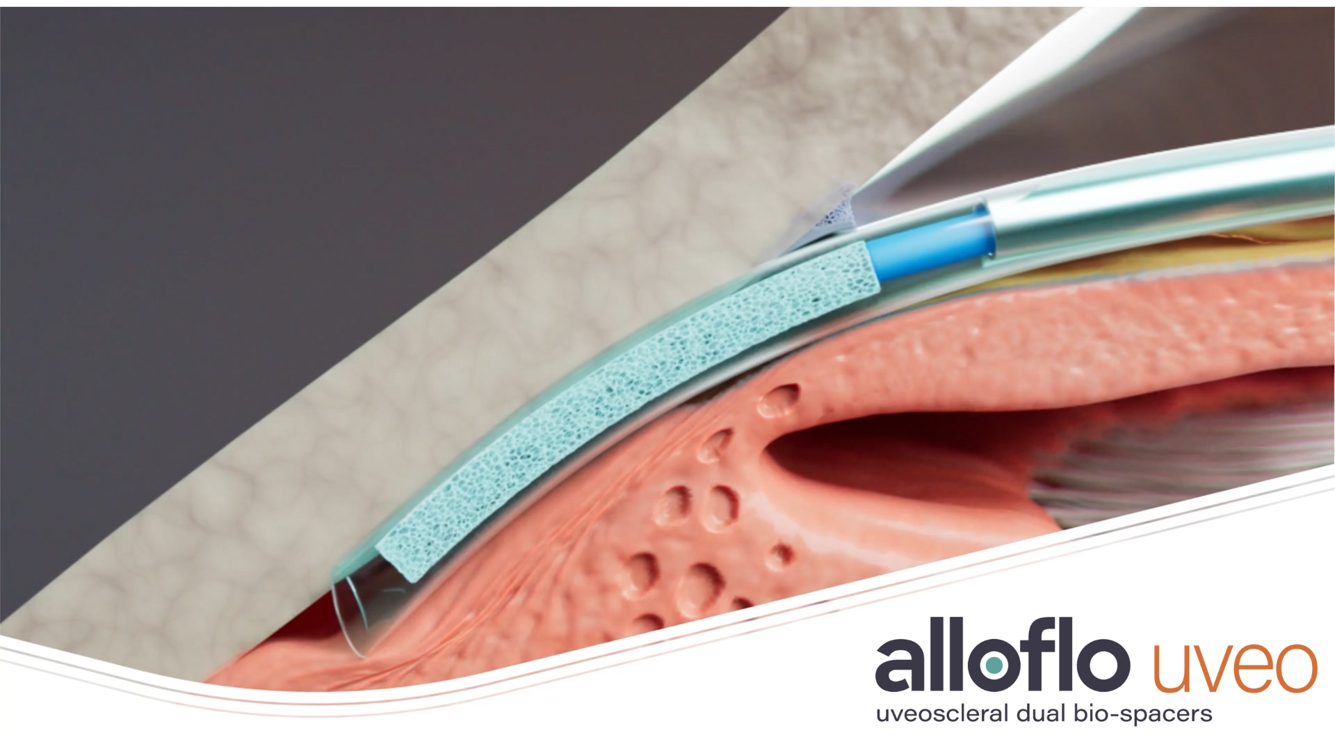 AlloFlo Uveo