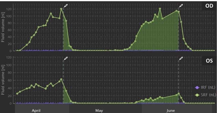 Fluid Volume Graphic