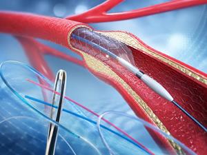 TekniPlex Healthcare Showcases Locally Manufactured Extrusion Solutions for China’s Medical Device Market at Medtec China 2026