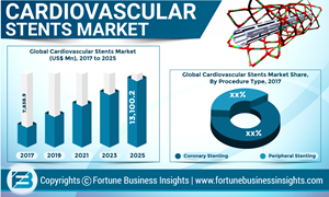 Abbott, Medtronic, and Boston Scientific Corporation leading the global Cardiovascular Stents market