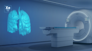 Polarean Highlights New CHEST Journal Study Demonstrating Xenon MRI Predicts Cystic Fibrosis Exacerbations
