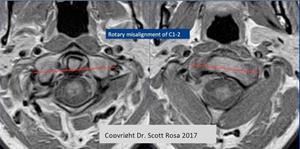 FONAR Reports on Publication of a Book Chapter Utilizing its UPRIGHT MRI