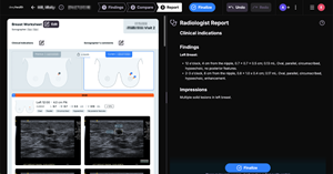 DeepHealth Receives FDA Clearance for AI-Powered Breast Ultrasound