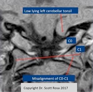 FONAR Reports on Publication of a Book Chapter Utilizing its UPRIGHT MRI