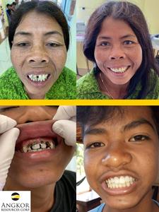 Angkor Dental Clinic